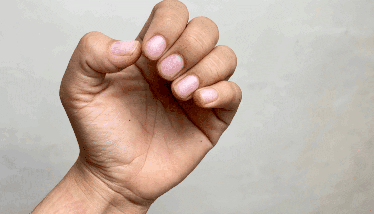 Suas unhas podem traçar um raio-x da sua saúde como um todo; veja quais são os principais sinais.